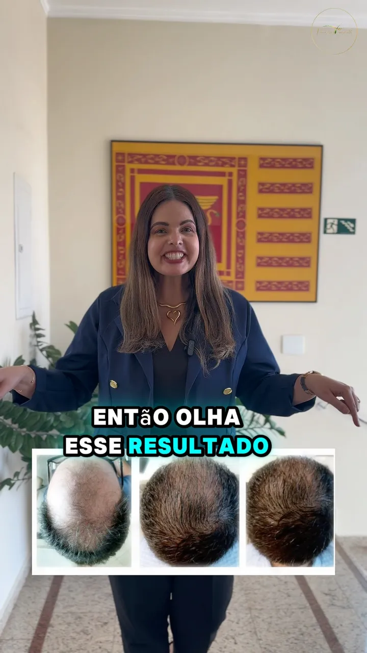 O que é a Terapia Capilar Vegana